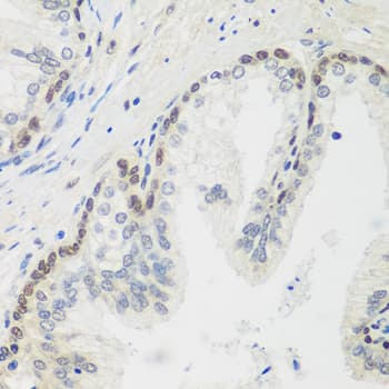 Polyclonal Rabbit anti-Human MDC1 Antibody (IHC, WB)