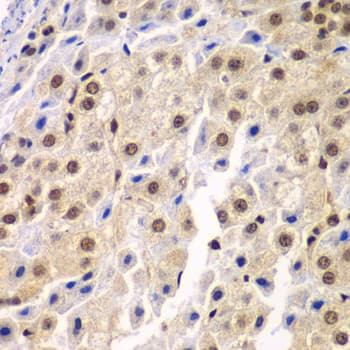 Polyclonal Rabbit anti-Human SF3B2 Antibody (IHC, IF, WB)