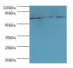 ABCF2 Antibody (aa1-250)