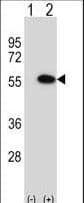 MINA / MINA53 Antibody (aa1-30)