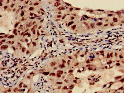 Polyclonal Rabbit anti-Human HIST1H3A Antibody (IHC, IF)