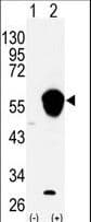 ALDH3A1 Antibody (aa69-99)