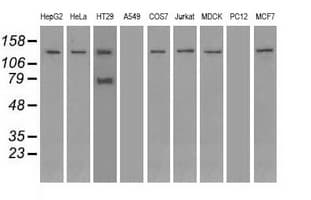 TRPM4 Antibody (clone OTI10H5)