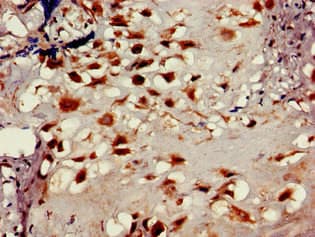 Polyclonal Rabbit anti-Human LOXL2 Antibody (IHC, WB)