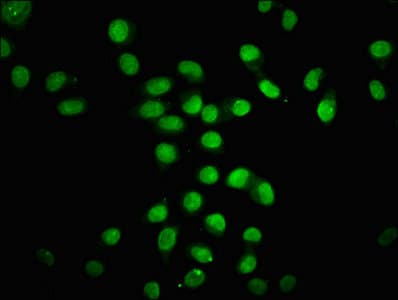 Polyclonal Rabbit anti-Human HIST1H4I Antibody (IHC, WB)