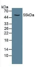 CAMK2A / CaMKII Alpha Antibody (aa1-478)