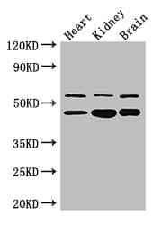 HNF4A / HNF4 Antibody