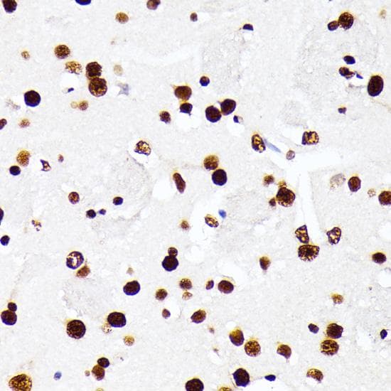 HNRNPD / AUF1 Antibody