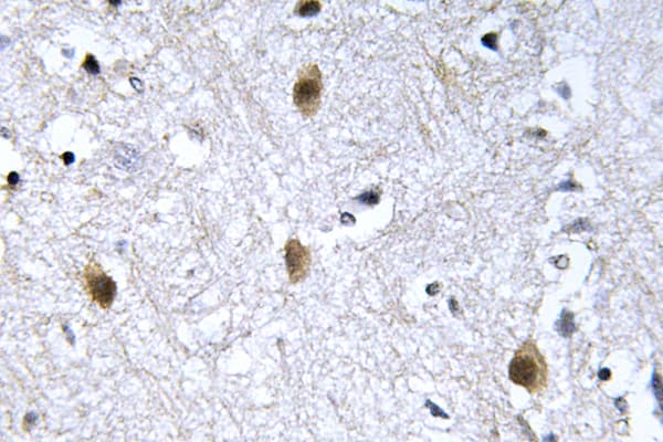IRS1 Antibody (Tyr632)