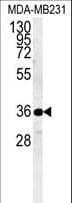 Polyclonal Rabbit anti-Human Myozenin / MYOZ1 Antibody (aa40-69, IHC, WB)