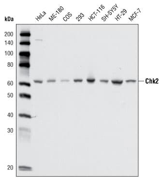 CHEK2 / CHK2 Antibody (clone 1C12B8)