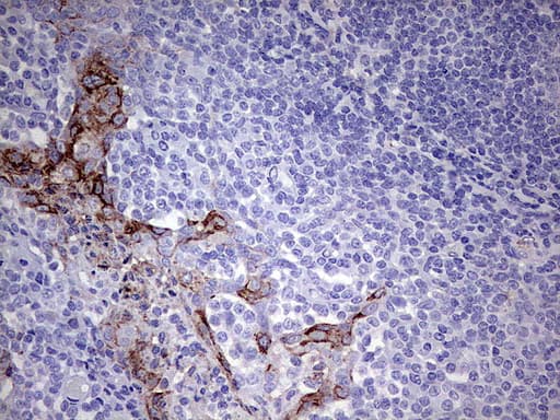 MMP7 / Matrilysin Antibody (aa95-267, clone UMAB168)