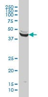IHC-plus™ ENO3 / Enolase 3 Antibody (clone 5D1)