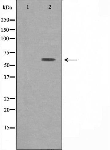 ATP6V1B1 Antibody
