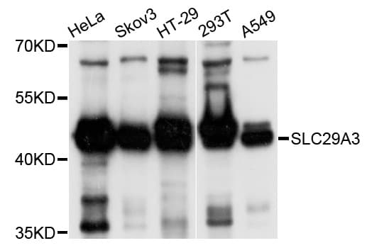 Polyclonal Rabbit anti-Human SLC29A3 / ENT3 Antibody (WB)