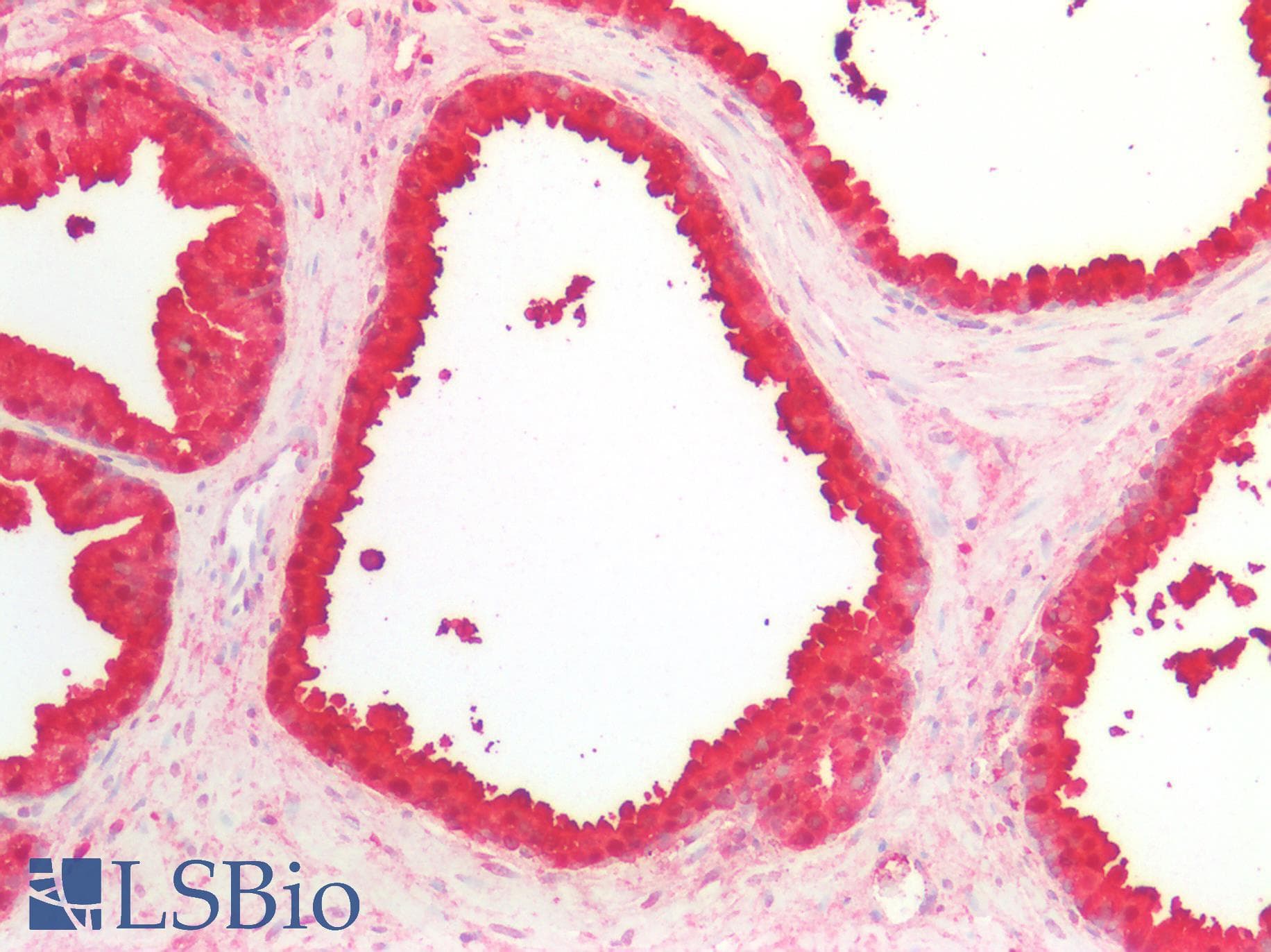 PathPlus™ MSMB / MSP Antibody