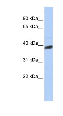 INSIG1 Antibody (C-Terminus)