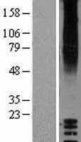 GPR87 Protein (Over-Expression Lysate Myc-DDK (Flag))