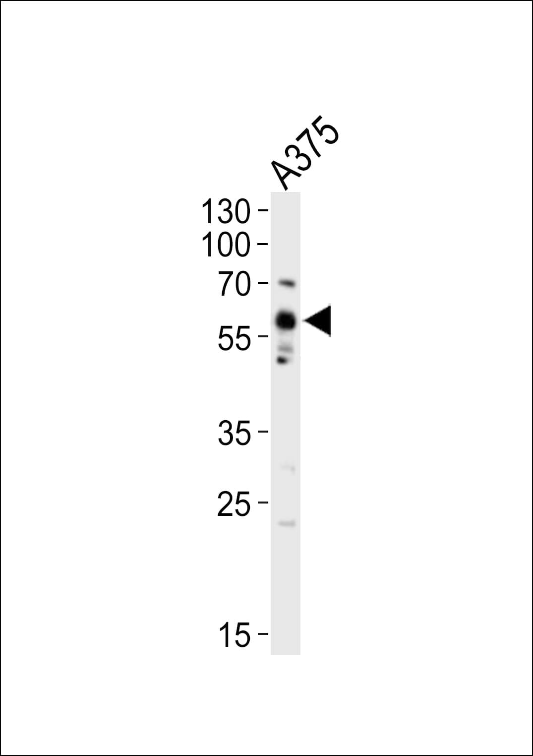 SRC Antibody (Tyr419)