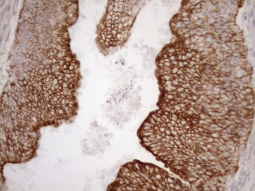 KRT16 / CK16 / Cytokeratin 16 Antibody (clone OTI1G1, Carrier-free)