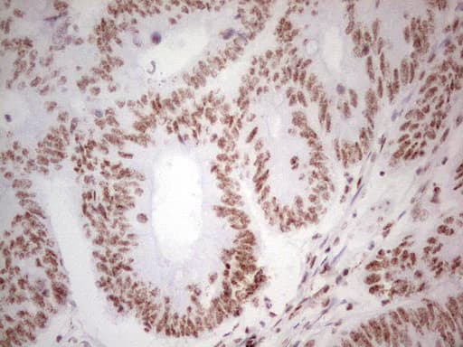 Monoclonal Mouse anti-Human ALKBH1 / ALKB Antibody (clone OTI1B8, aa1-245, IHC)