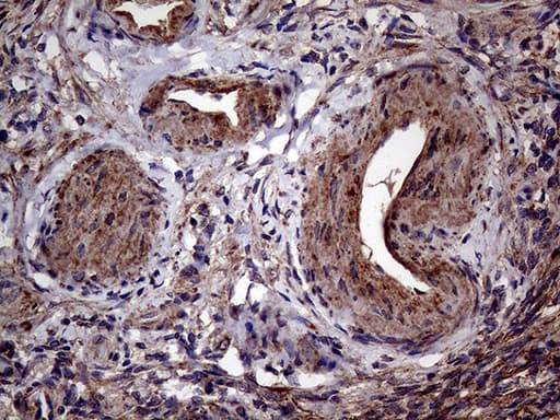 AGR2 Antibody (aa21-175, clone OTI3B5, Carrier-free)
