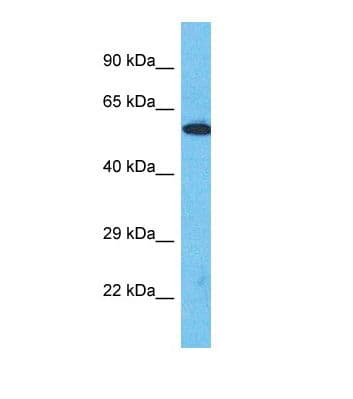 MCCC2 / MCCB Antibody (aa82-131)