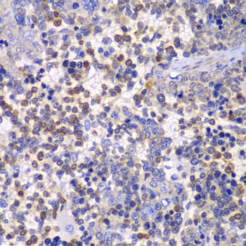 FAK / Focal Adhesion Kinase Antibody
