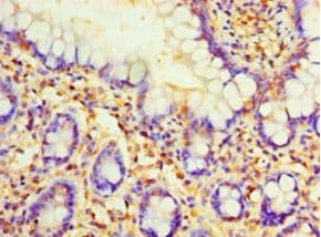 PVALB / Parvalbumin Antibody (aa2-110)