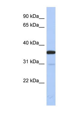 Polyclonal Rabbit anti-Human Esterase D / ESD Antibody (N-Terminus, WB)