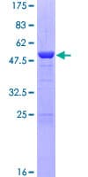 Human DGCR6 Protein (Recombinant GST)