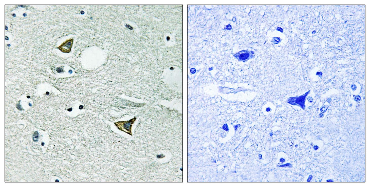 Polyclonal Rabbit anti-Human CCDC88A / GIV / Girdin Antibody (Ab-1417, IHC)