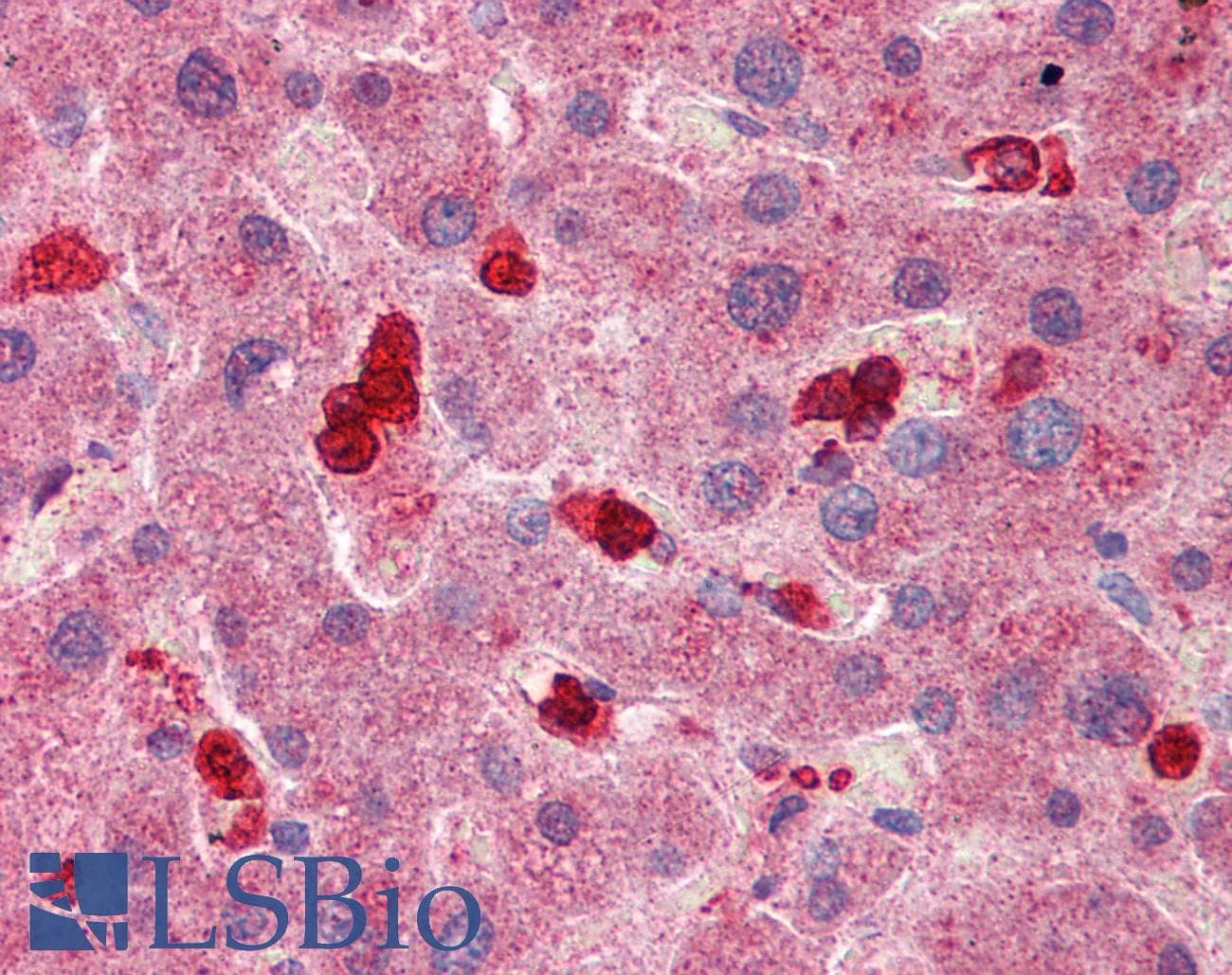 Polyclonal Rabbit anti-Human SLC8A3 / NCX3 Antibody (aa144-193, IHC, WB)