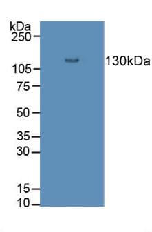 DSG3 / Desmoglein 3 Antibody (aa858-999)