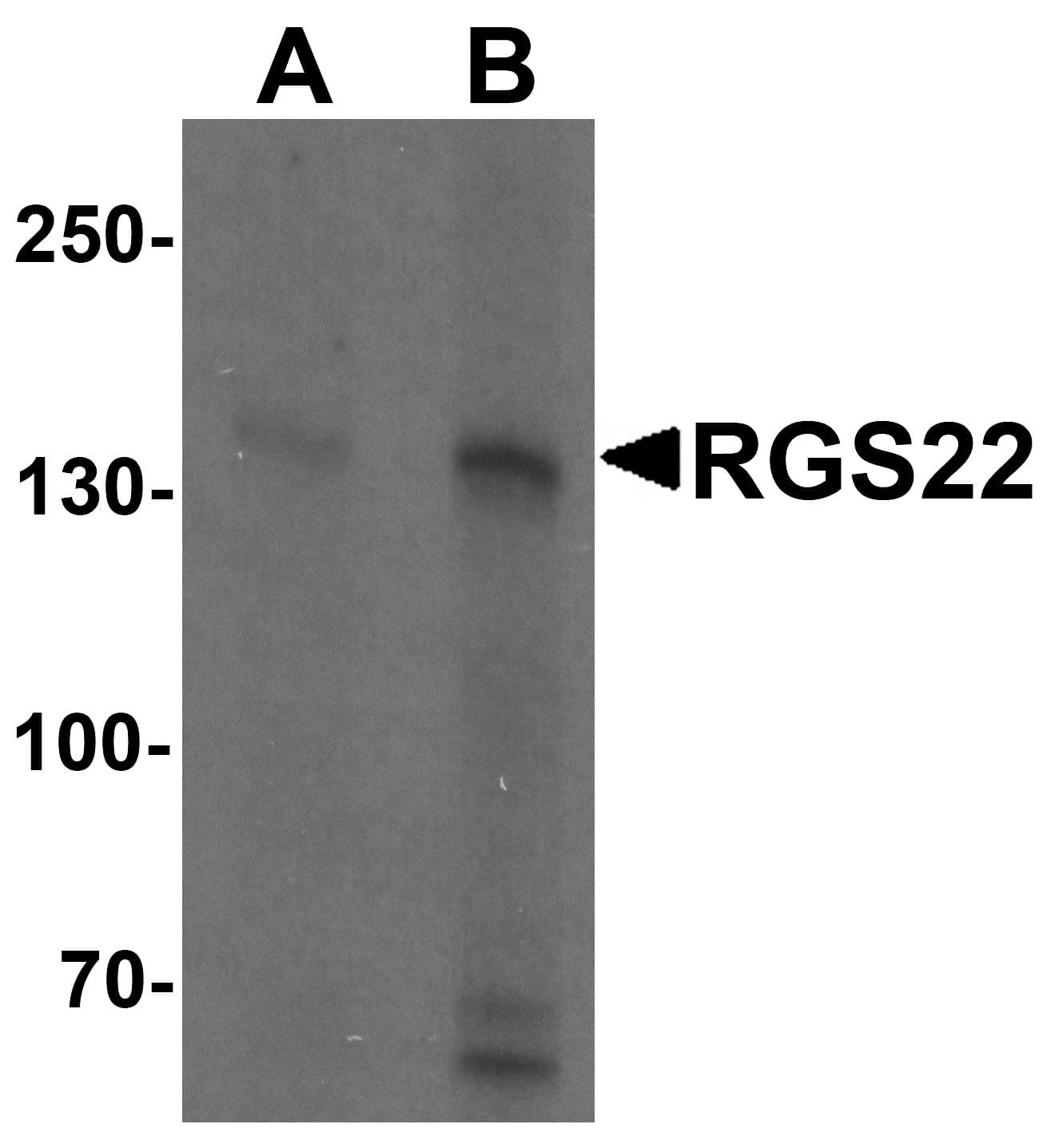IHC-plus™ RGS22 Antibody