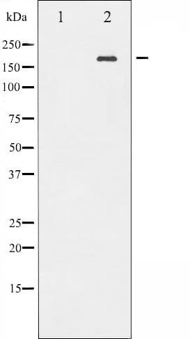Polyclonal Rabbit anti-Human EGFR Antibody (phospho-Tyr869, IF, WB)