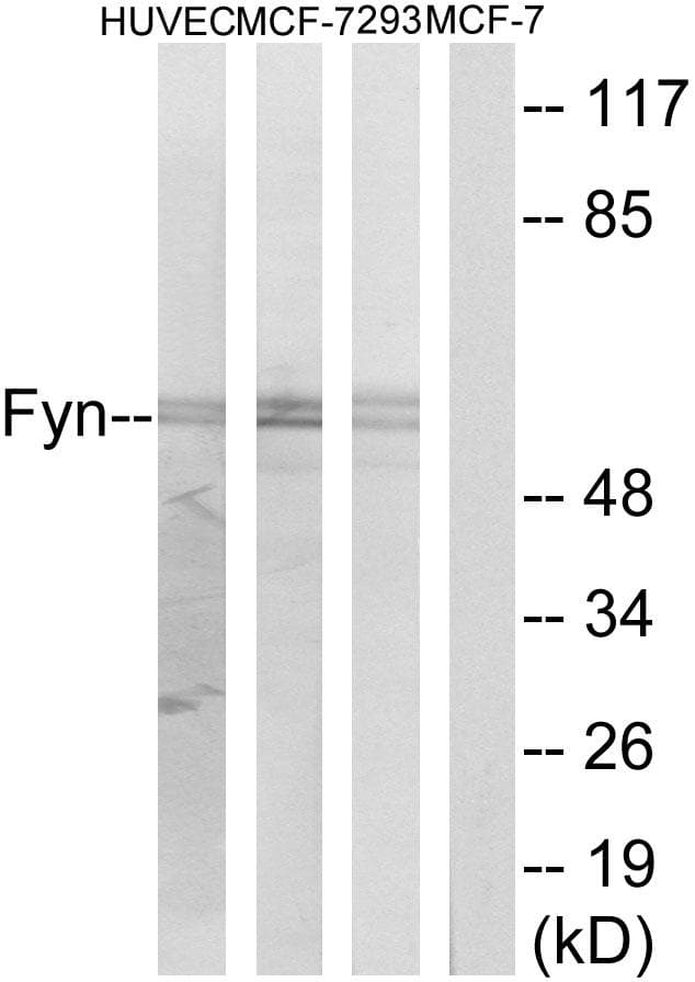 Polyclonal Rabbit anti-Human SYN / FYN Antibody (p530, WB)