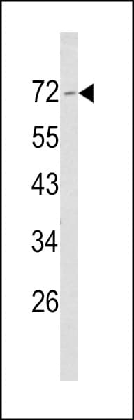 NF2 / Merlin Antibody (aa65-95)