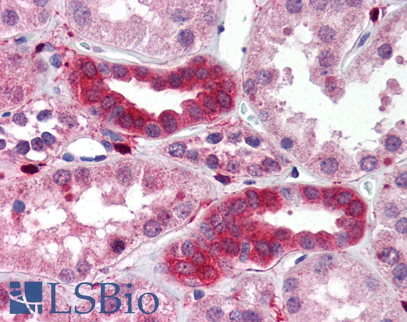 IHC-plus™ TAB1 Antibody