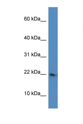 RPL26 / Ribosomal Protein L26 Antibody (C-Terminus)