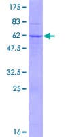 Human TSSK6 Protein (Recombinant GST)