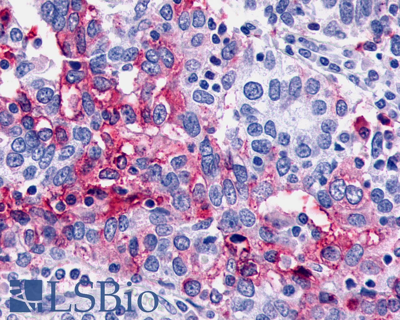 PathPlus™ CELSR1 Antibody (N-Terminus)