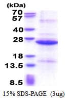 Human REXO1 / REX1 Protein (Recombinant His)