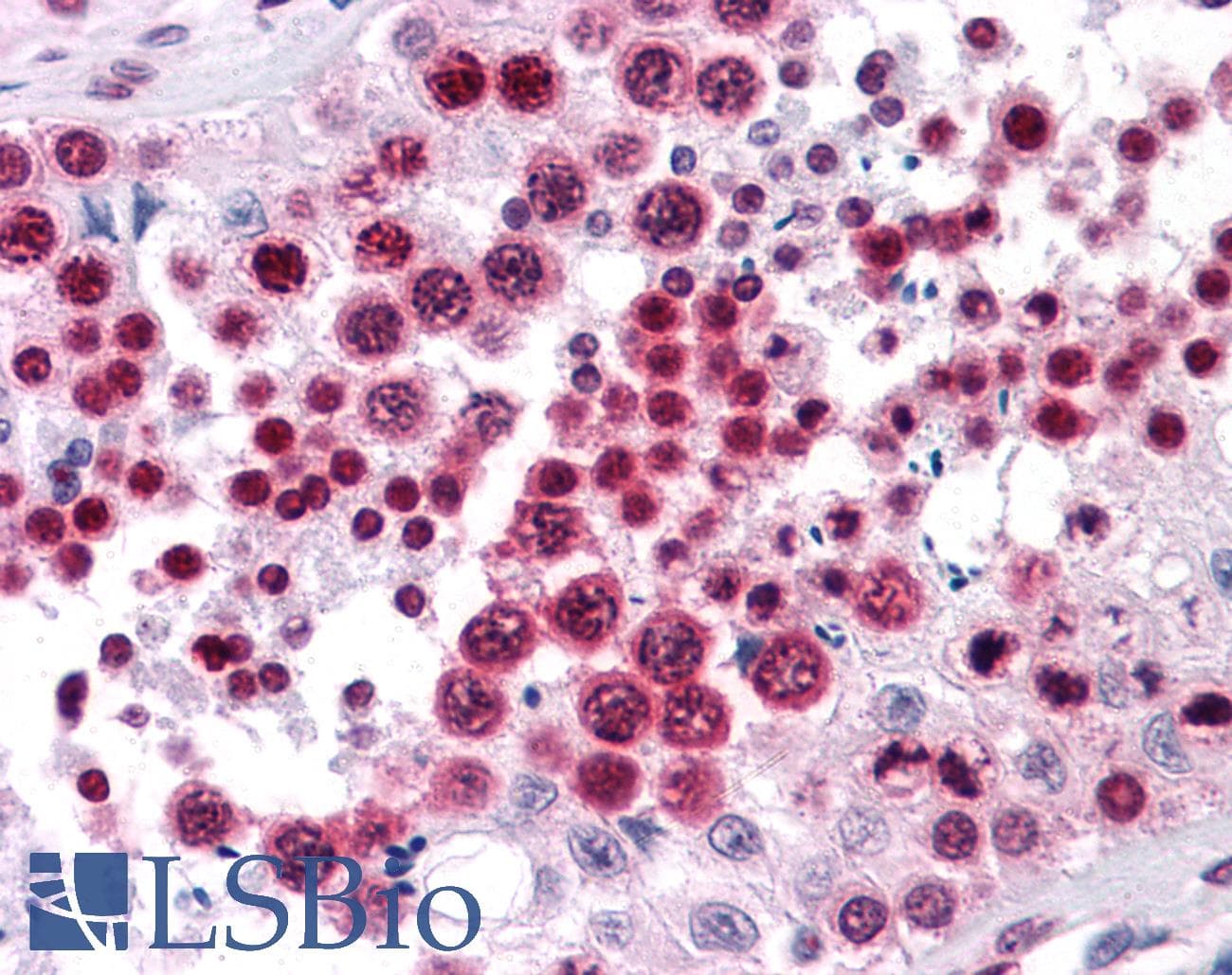 IHC-plus™ Monoclonal Mouse anti-Human HMG2 / HMGB2 Antibody (clone 3D2, IHC, IF, WB)
