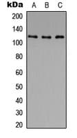 Histone Deacetylase HDAC5 / HDAC9 Antibody (phospho-Ser259/Ser220)