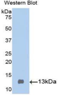 CST3 / Cystatin C Antibody (aa46-147)