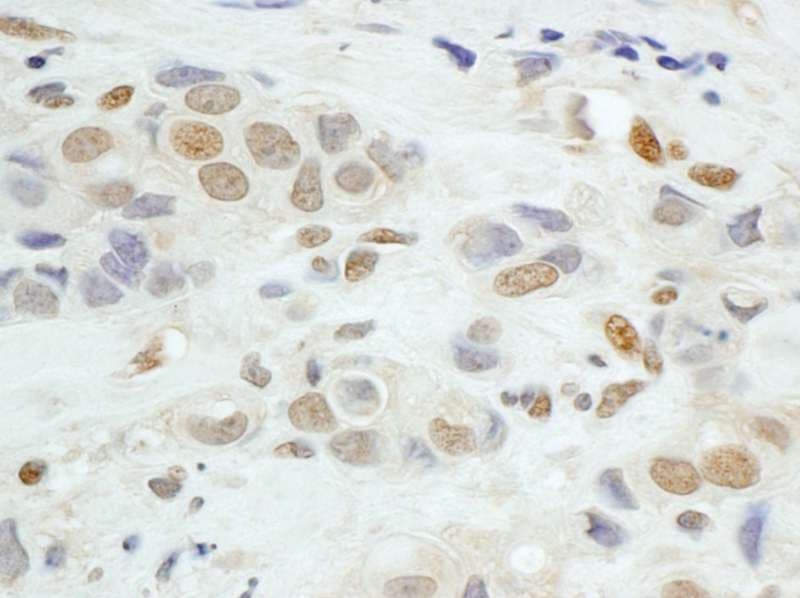 JUNB / JUN-B Antibody (aa1-40)