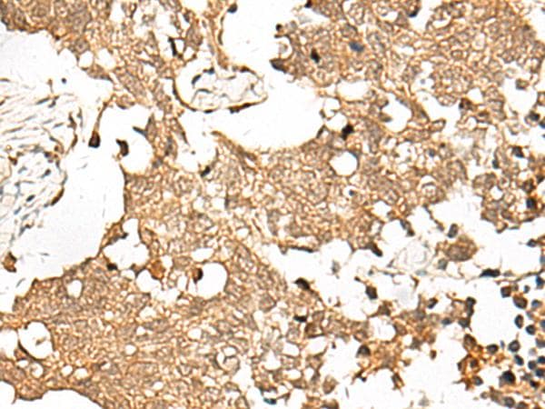 SNAPC5 Antibody