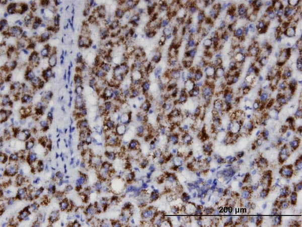 Monoclonal Mouse anti-Human ACAA1 Antibody (clone 3F11, IHC, WB)
