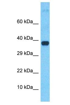 Polyclonal Rabbit anti-Human USP4 Antibody (aa313-362, WB)